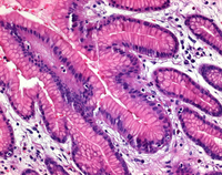HEMATOXYLIN (C.I. 75290) CRYST.